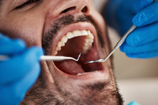 Best Periodontal (Gum) Disease Treatment  in Hiawatha, KS